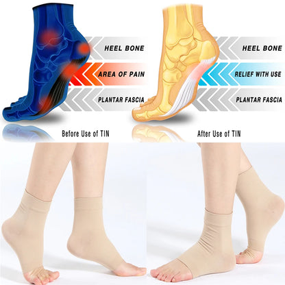 Arch support